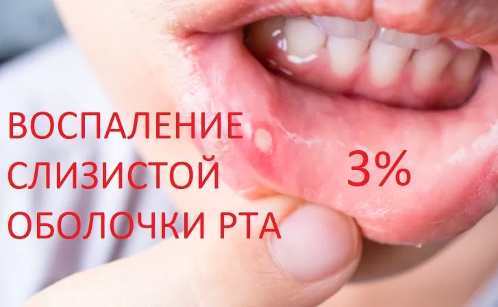 Воспаление слизистой рта приводит ребенка к ортодонту в 3% случаев